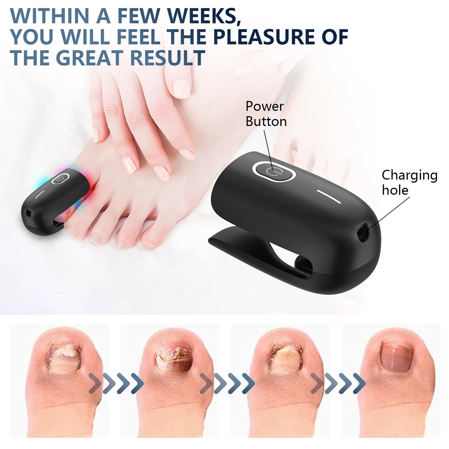 The Anti-Fungal Toenail Laser Therapy Machine with USB Charge - Homevalley.co.uk