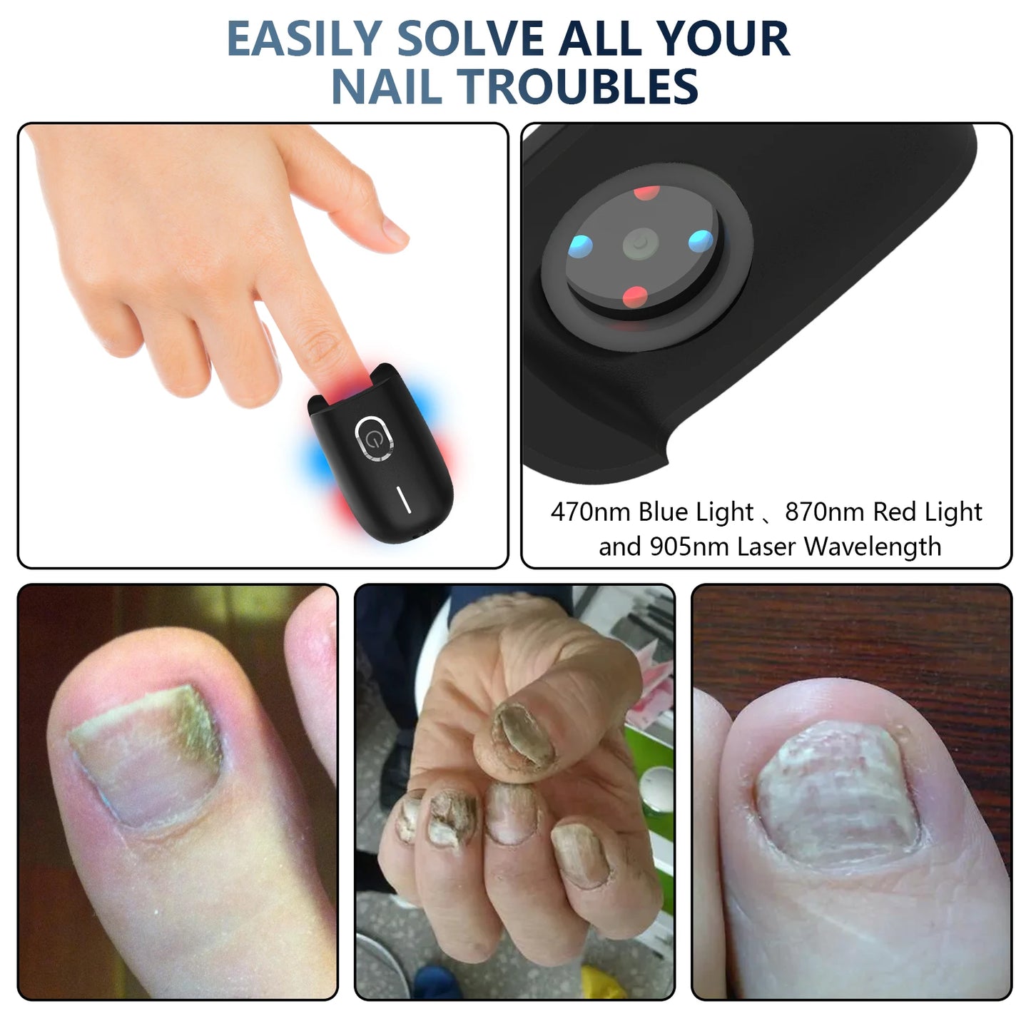 The Anti-Fungal Toenail Laser Therapy Machine with USB Charge - Homevalley.co.uk