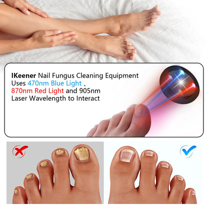 The Anti-Fungal Toenail Laser Therapy Machine with USB Charge - Homevalley.co.uk