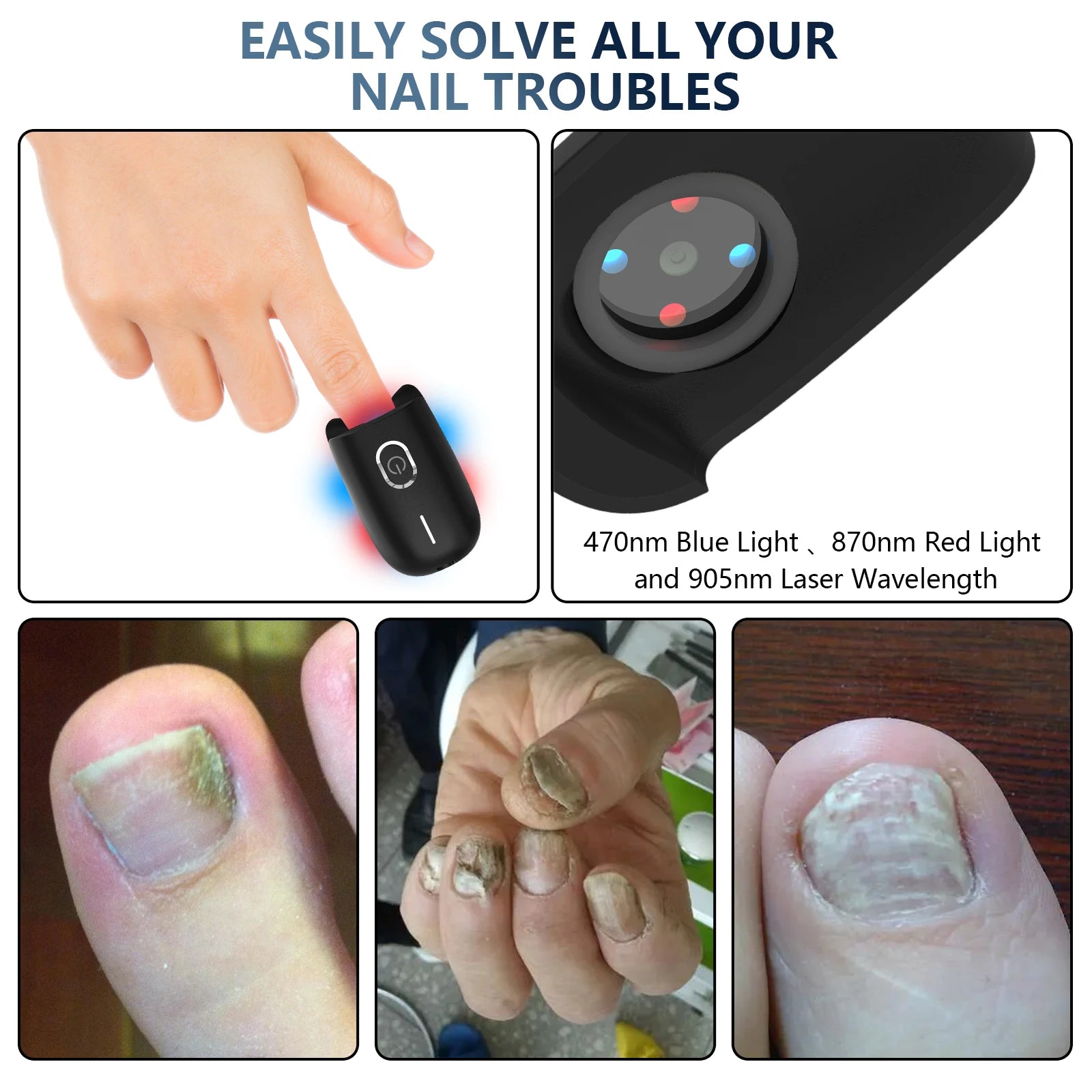 The Anti-Fungal Toenail Laser Therapy Machine with USB Charge - Homevalley.co.uk