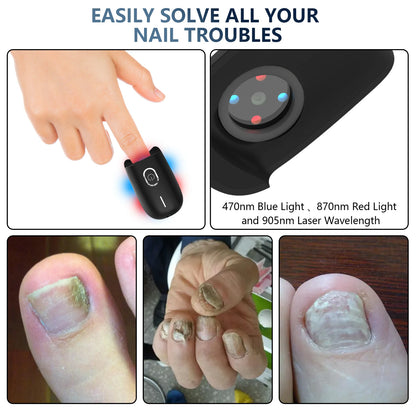 The Anti-Fungal Toenail Laser Therapy Machine with USB Charge - Homevalley.co.uk